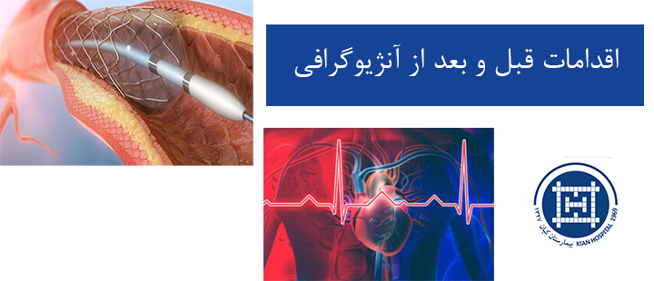 اقدامات قبل و بعد از آنژیوگرافی
