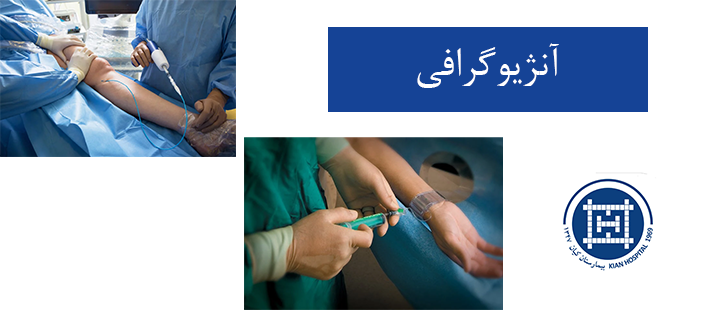 درباره-آنژیوگرافی