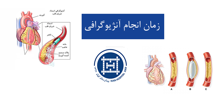 زمان انجام آنژیوگرافی