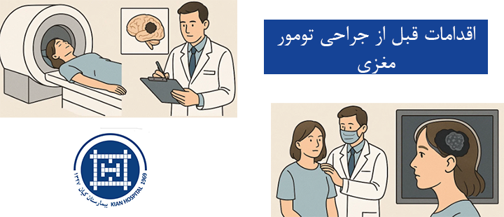 اقدامات قبل از جراحی تومور مغزی