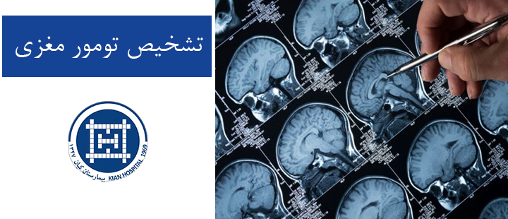 تشخیص تومور مغزی 