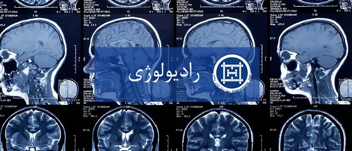 رادیولوژی