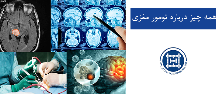 همه چیز درباره تومور مغزی 