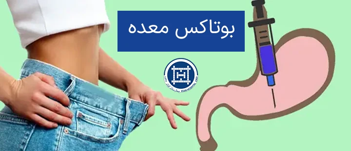 بوتاکس معده چیست؟