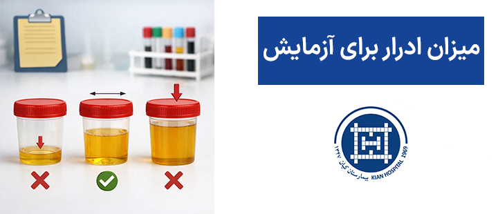 میزان ادرار برای آزمایش